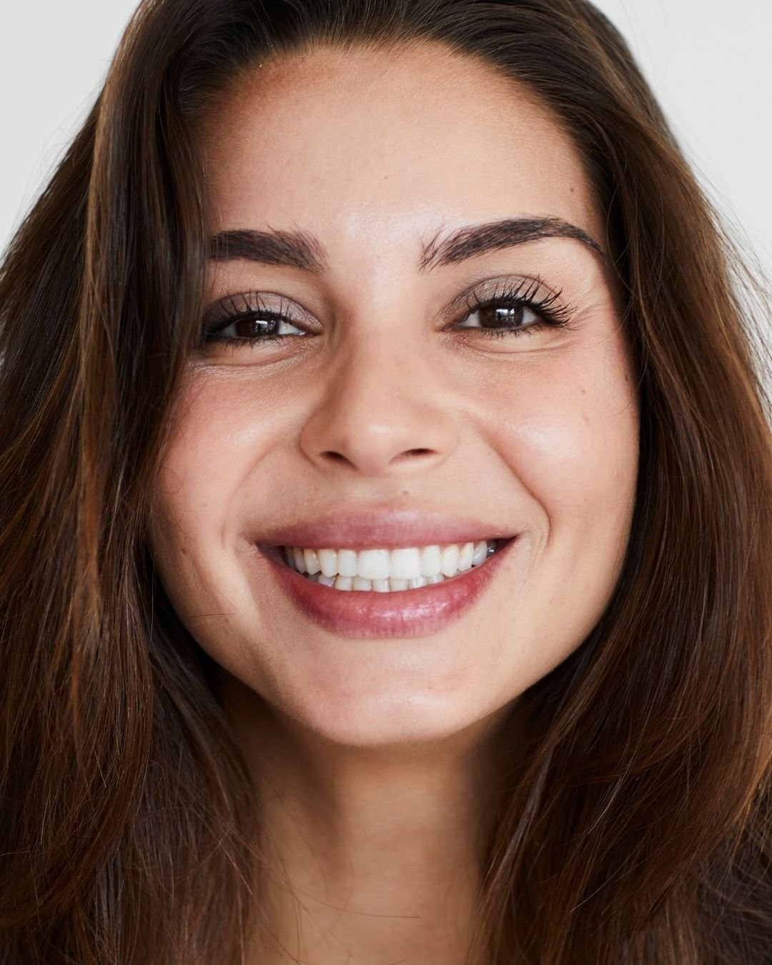 Digital Smile Design
