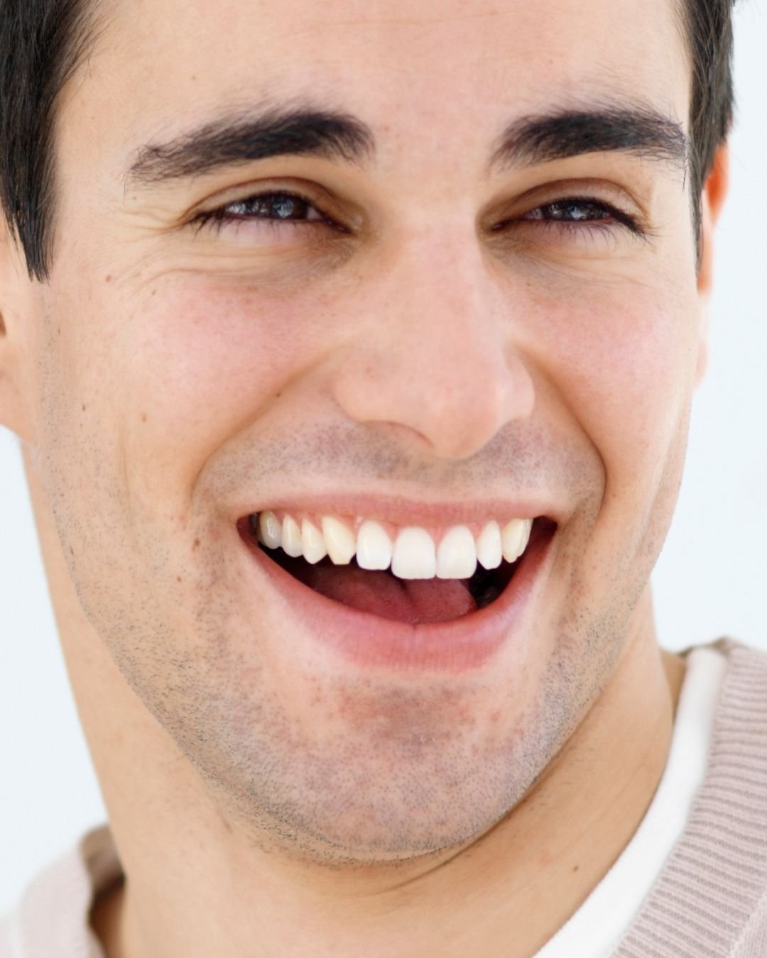 Zirconium Crowns